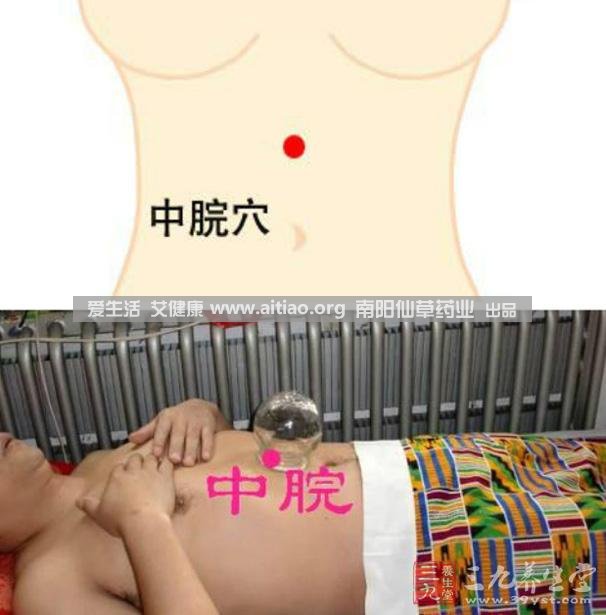 中脘穴位于腹部正中線(xiàn)，臍上4寸的位置上。每天艾灸10-15分鐘，能有效緩解胃部不適的癥狀，同時(shí)有助于祛濕。